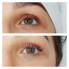 Wimpernlifting