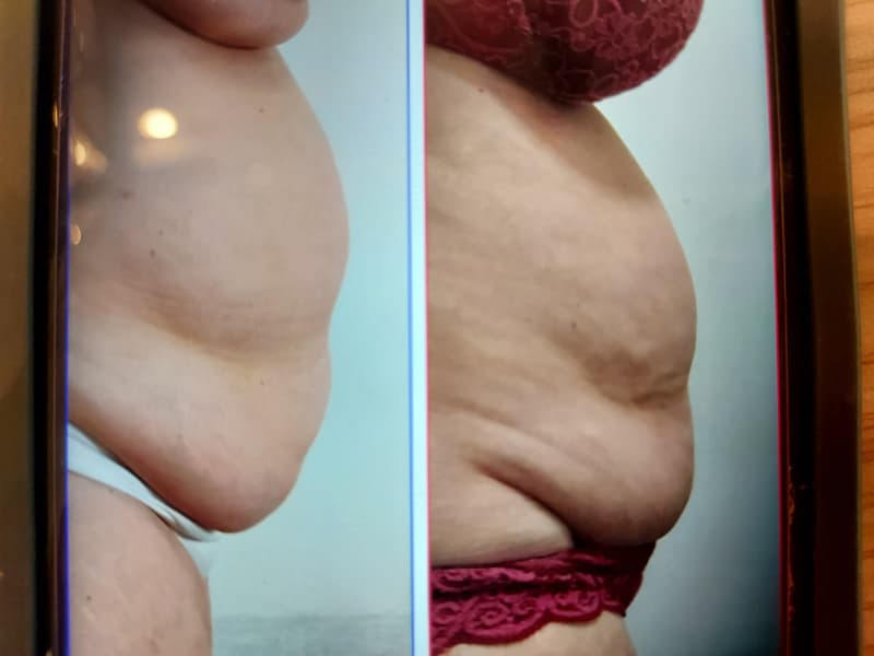 Revolutionären Figurkonzepts „BODY SHAPE“ Ihrer Traumfigur näher