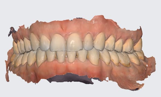 3D-Scan des Mundraumes