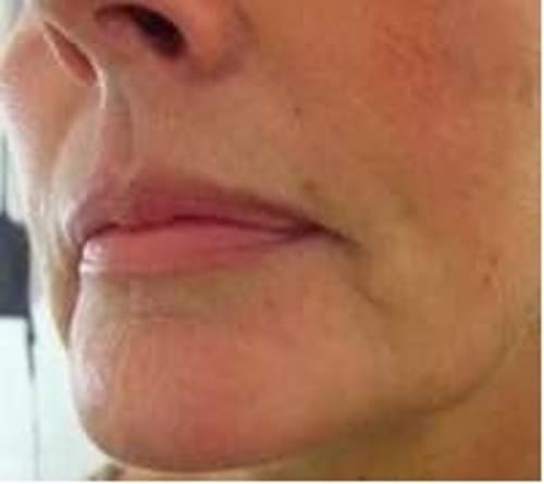2 x Propolis-Salbe "EXTRA STARK" direkt vom Imker!