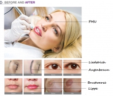 Permanent Make-Up -Mesotherapie/Microneedling/Kryolipolyse 