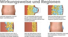 Kryolipolyse / Fettreduktion ohne OP