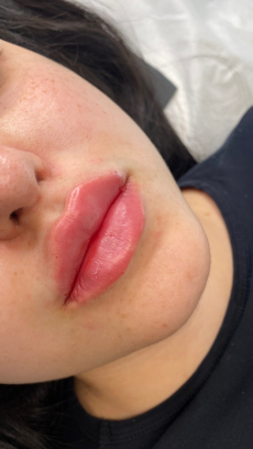 Perkte lippe