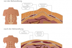 EM SHAPE X für Muskelaufbau Orginal Neu 17'900 anstatt 23'500