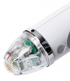 Secret RF - Microneedling Gerät mieten oder Leasingübernahme