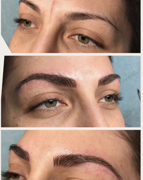 Microblading