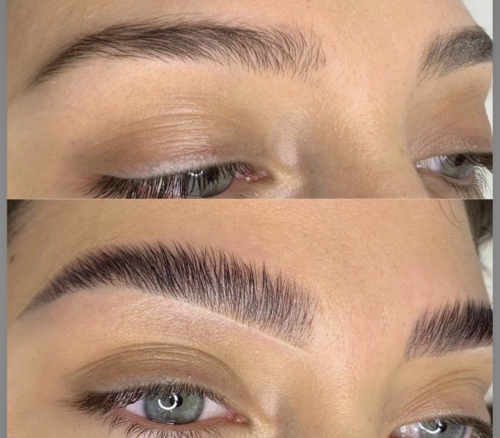 Aktuell Brows-Lifting Aktion 